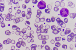 In Vitro Model Systems: Accelerating Oncology Drug Discovery