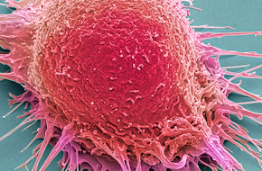 Cell Line Derived Tumor Models