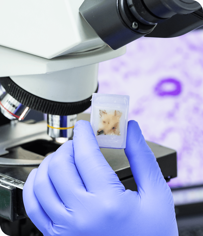 Human Biospecimen Solutions | Crown Bioscience