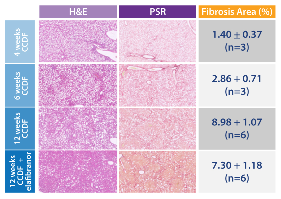 Liver Fibrosis Model