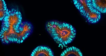 Advantages in 3D In Vitro Modeling with HUB Organoids