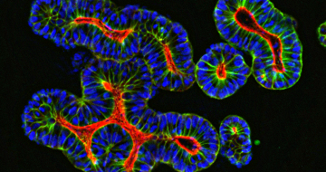 Disrupting the Oncology Drug Development Workflow with PDXO Models