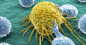 How to Choose the Correct I/O Model