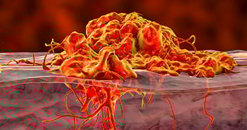 Imaging Orthotopic and Metastatic Preclinical Tumor Models