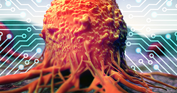 OncoExpress™