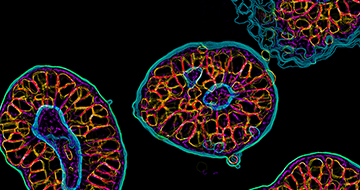 Organoids for Preclinical Oncology Drug Development and Validation