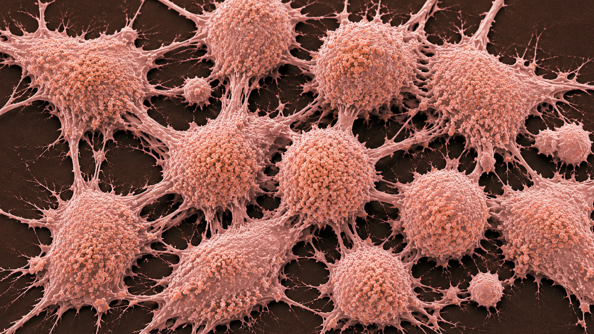 Advancing Prostate Cancer Drug Discovery with Translational Preclinical Models