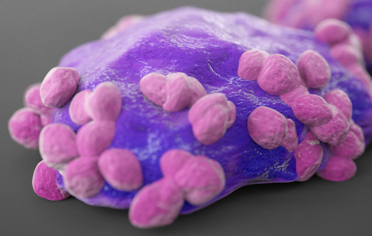 Diffuse Large B Cell Lymphoma PDX Models