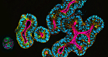Tumor Organoid Immuno-Oncology Applications