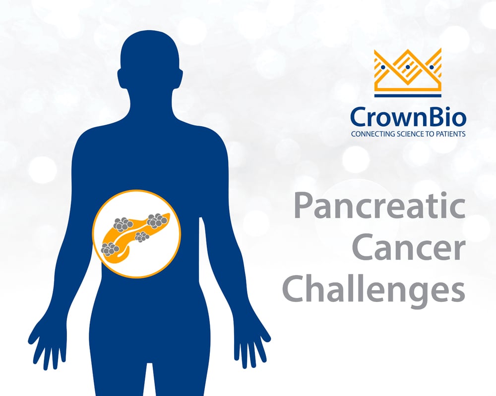 Challenges and Opportunities in Pancreatic Cancer Research