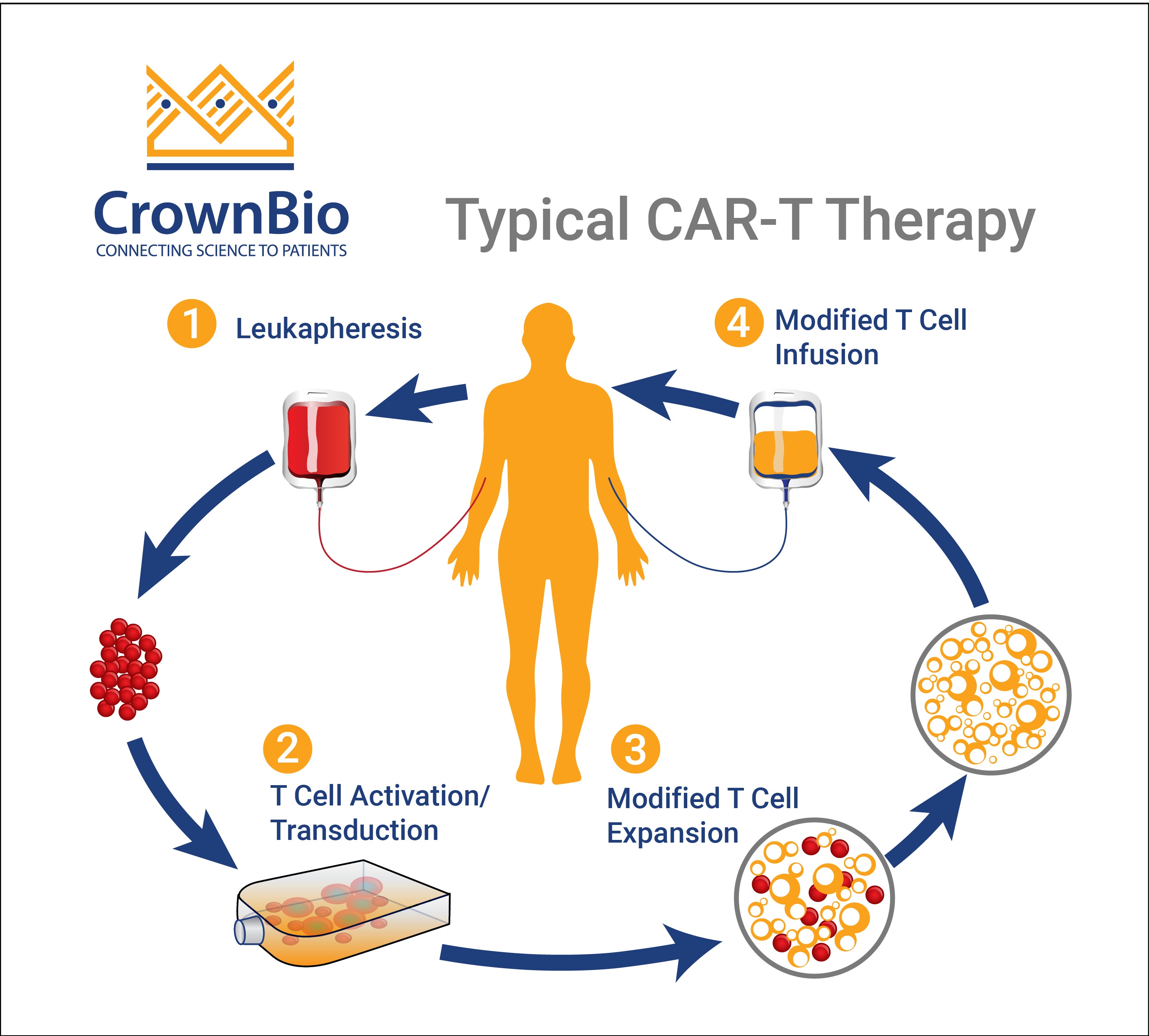 Post FDA Approval: CAR-T Therapy Key Facts