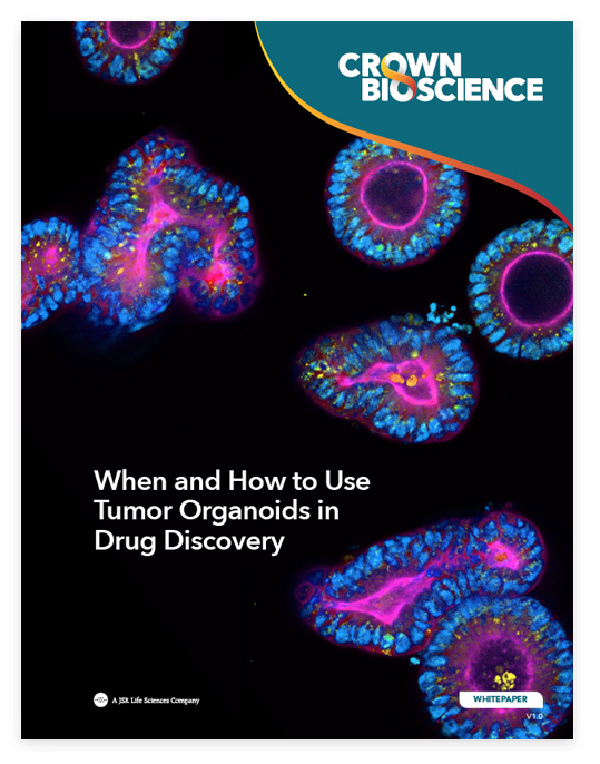 When and How to Use Tumor Organoids in Drug Discovery