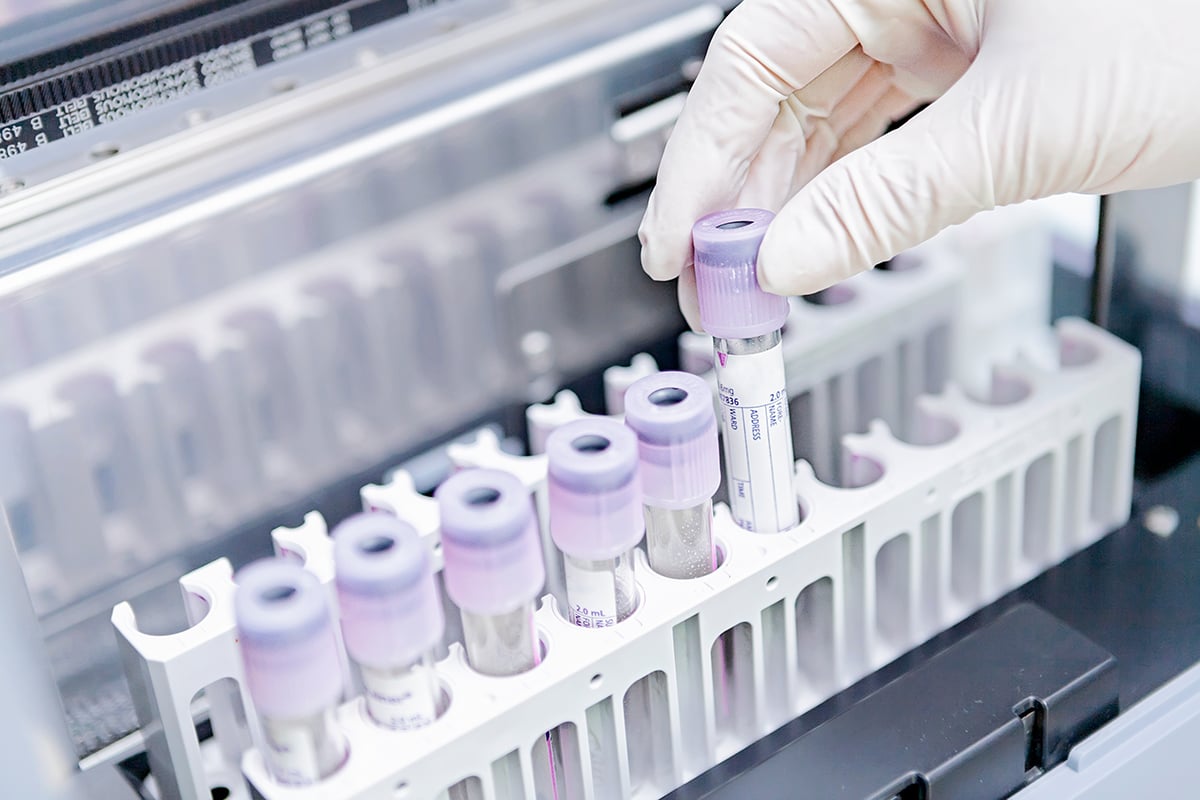 The Critical Role of Biospecimen Quality in Translational Research