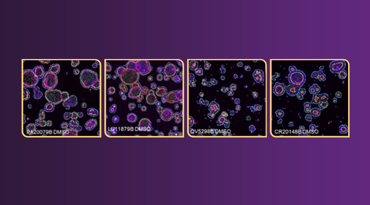 The Role of High-Content Analysis in 3D Organoid Imaging