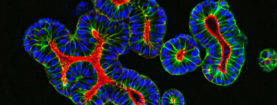 Transforming Drug Discovery with 3D Adult Stem Cell Organoids and High Content Imaging