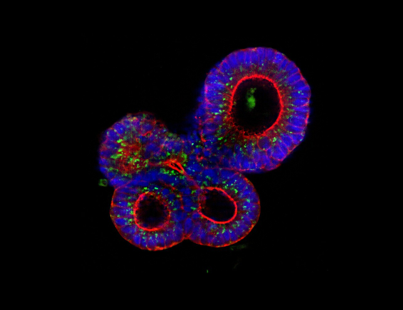 cell-line-and-mixed-tmas