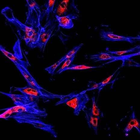 bioluminescent-imaging-of-tumor-models-1