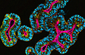 organoidxplore