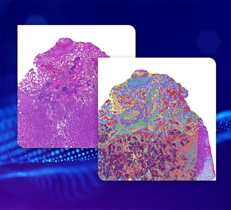 spatial-transcriptomics