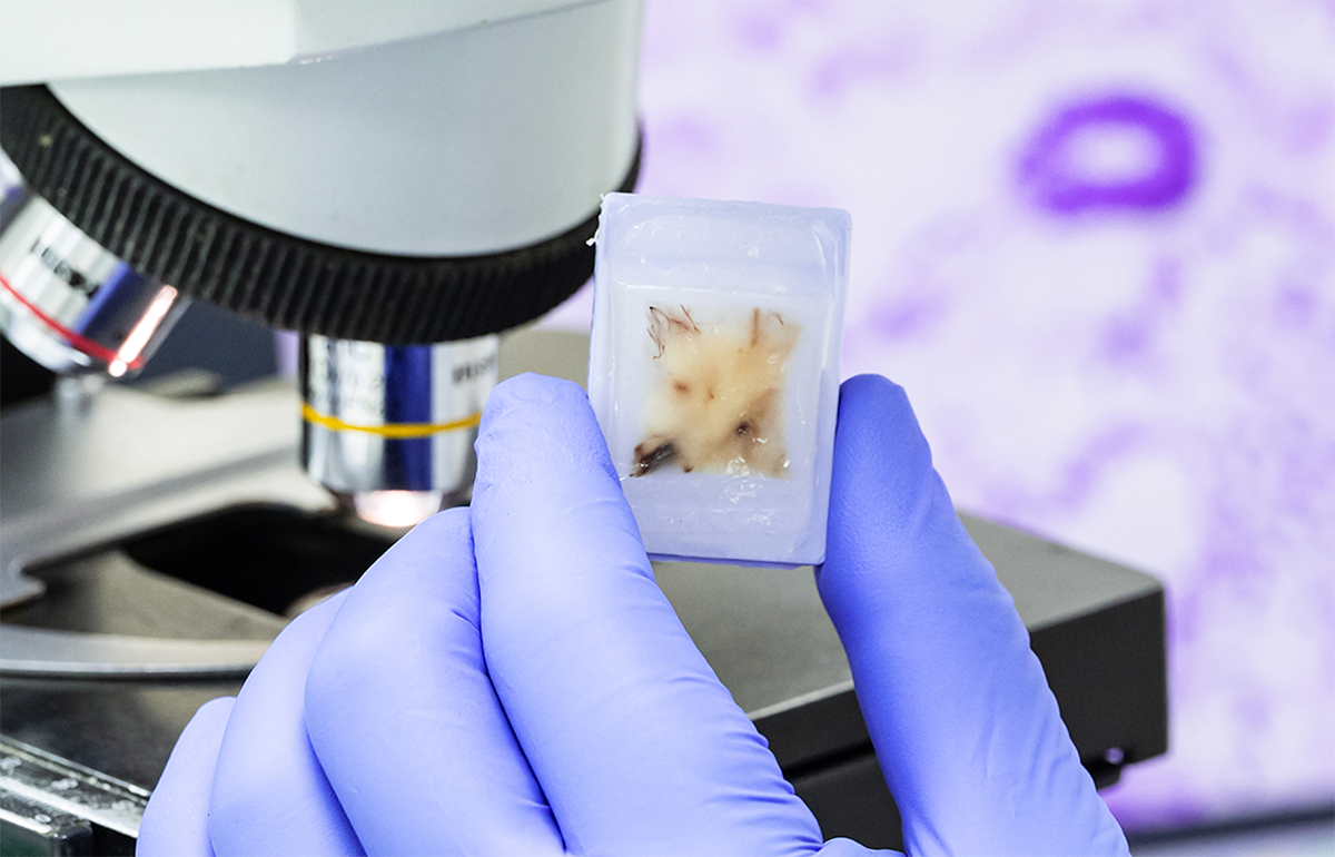 human-clinically-annotated-tmas