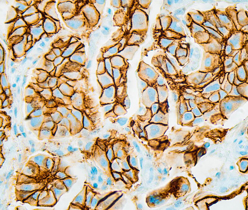 Immunohistochemistry Services