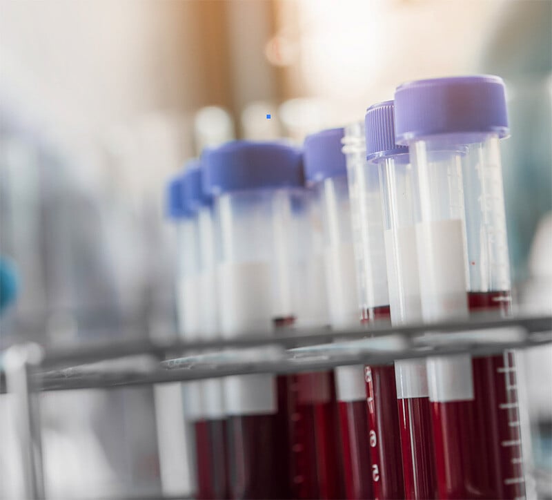 Liquid Biopsy (Longitudinal Cell-free Plasma)