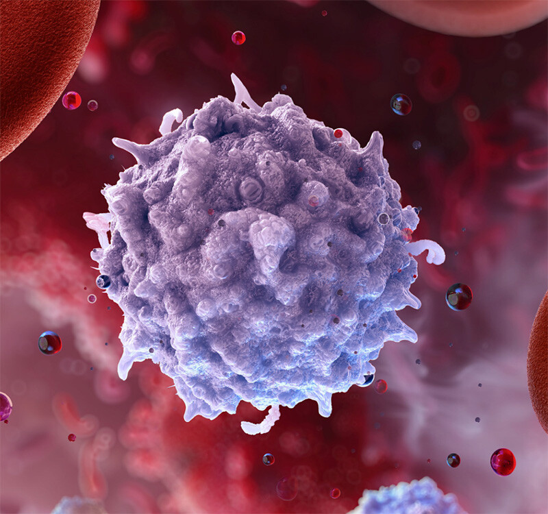 Dissociated Tumor Cells/Tumor Infiltrating Lymphocytes
