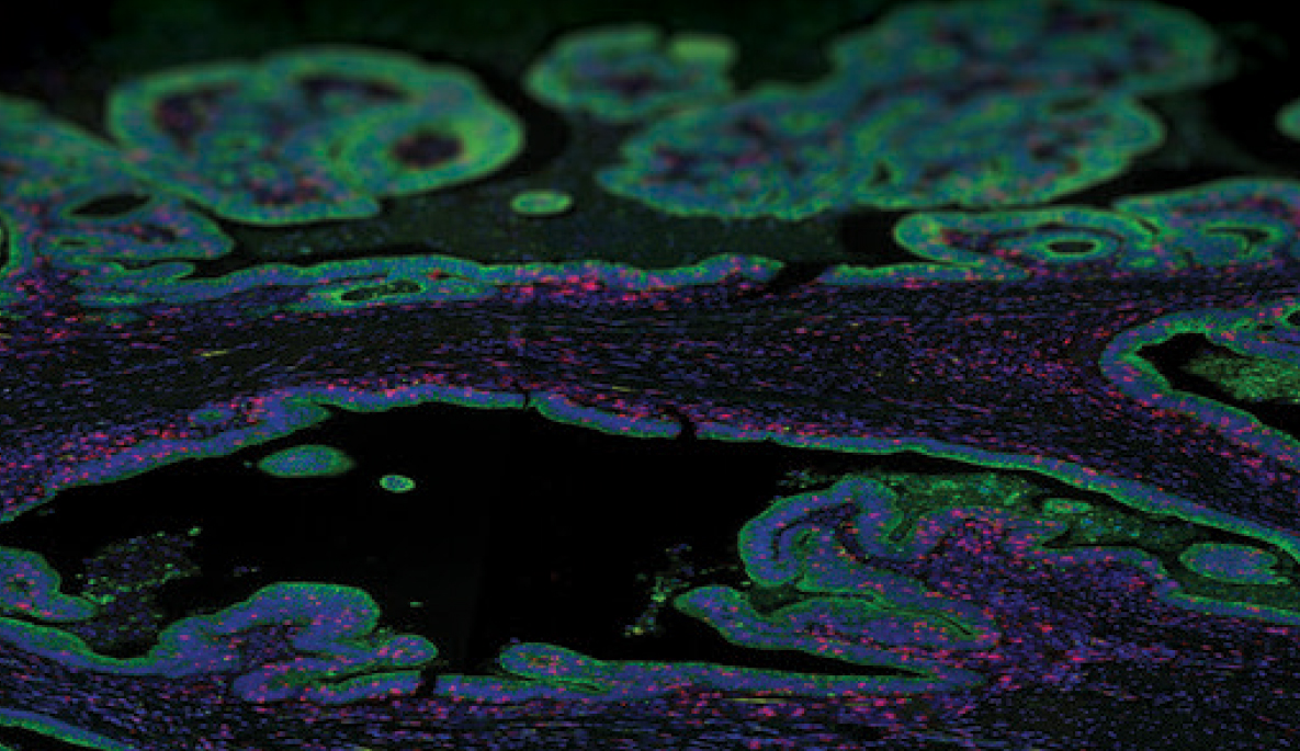 Nanostring Spatial Multi-omics Services