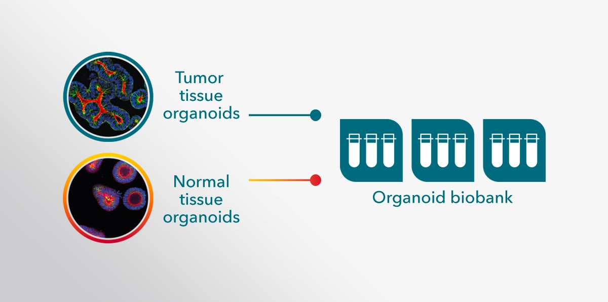 Organoid Biobanks: Living Predictive Models for Cancer Drug Development