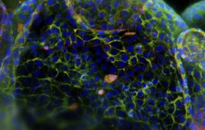 Drug Discovery in 3D