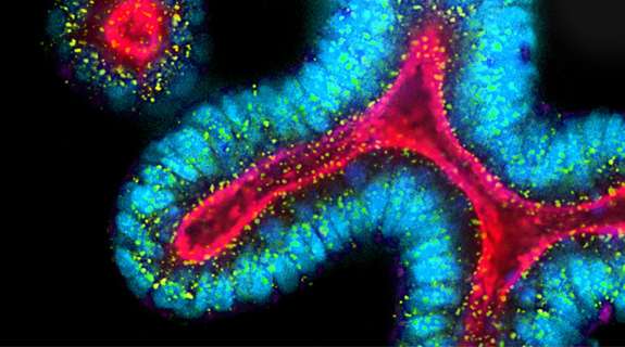 Screening and Profiling The Added Value of High Content Imaging