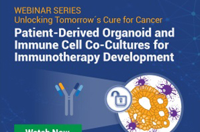 Patient-Derived Organoid and Immune Cell Co-Cultures for Immunotherapy Development