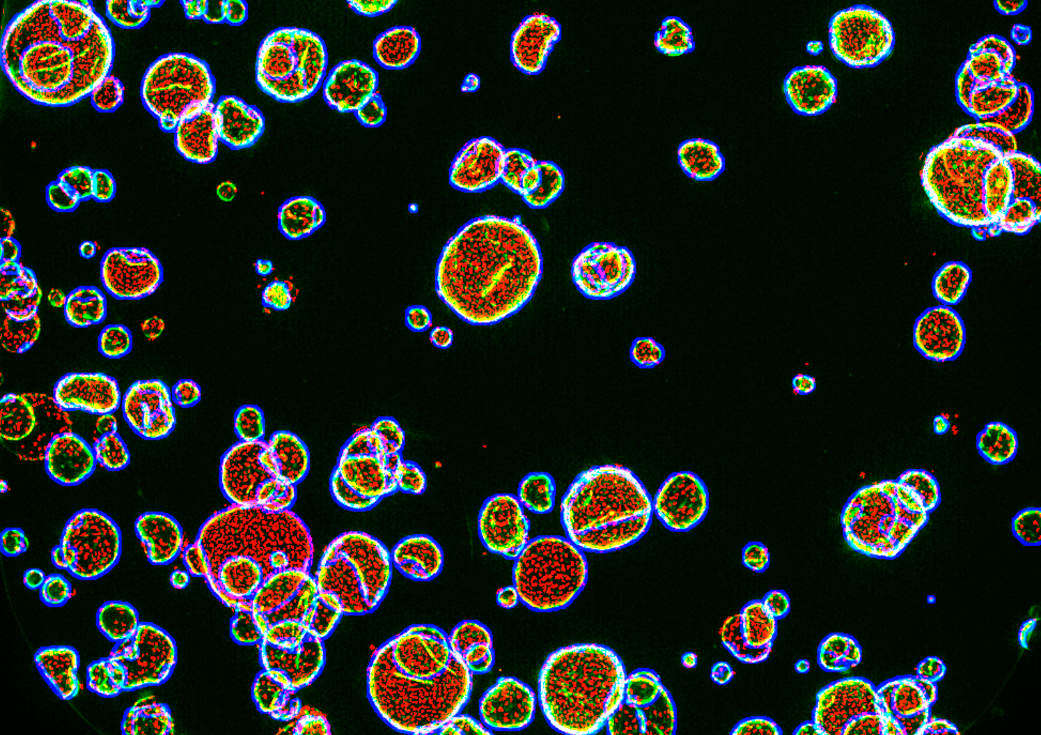 Large-Scale Organoid Panel Screening: Revolutionizing Oncology Drug Discovery